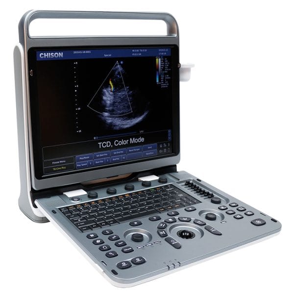 ULTRASONIDO PORTÁTIL  EBit50 CHISON