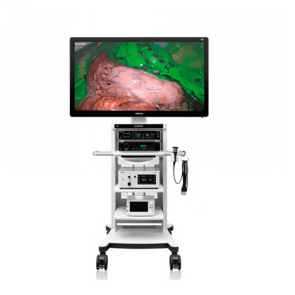 Torre de Laparoscopia con Pantalla de 55 pulgadas 4K modelo UX5 - Marca Mindray