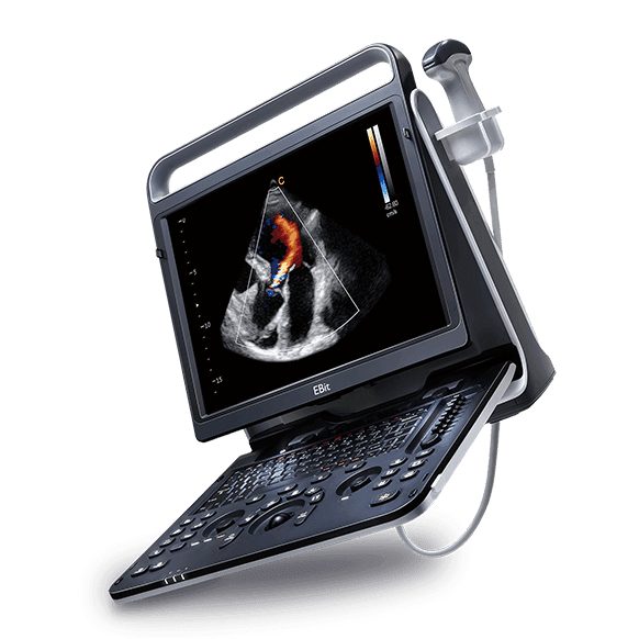 Ultrasonido EBit 60 CHISON