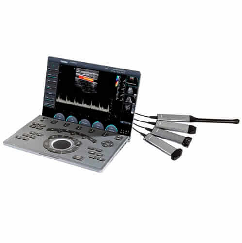 SonorAir 30 Ultrasonido CHISON